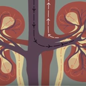 Chronic Kidney Disease